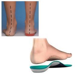 Manufacturers Exporters and Wholesale Suppliers of Podiatry Foot Care Surat Gujarat